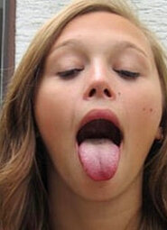 erotiss