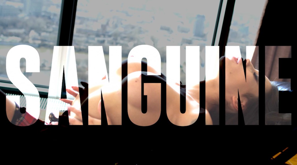 SANGUINE