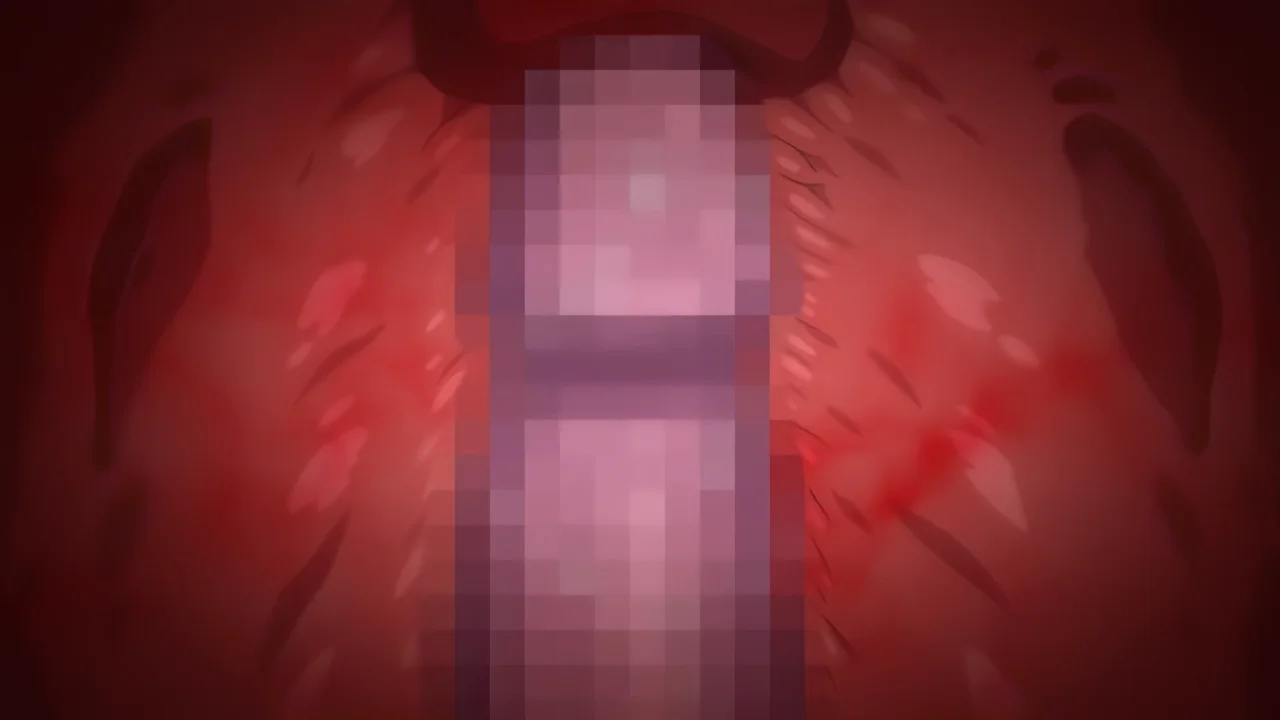 Thumbnail at 4:06