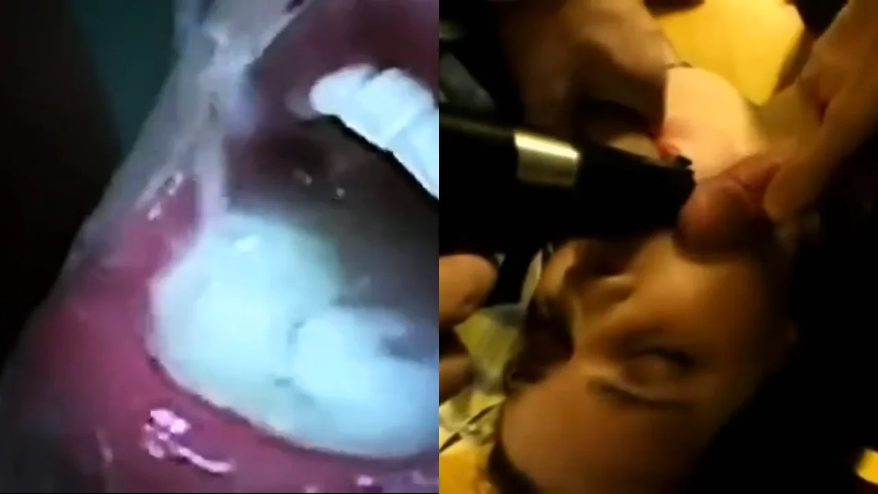 Thumbnail at 1:10