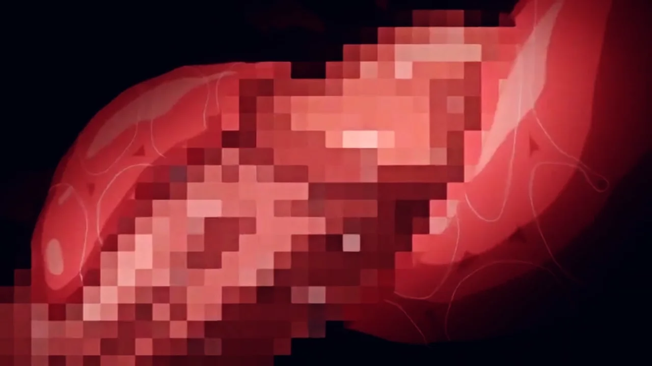 Thumbnail at 0:15