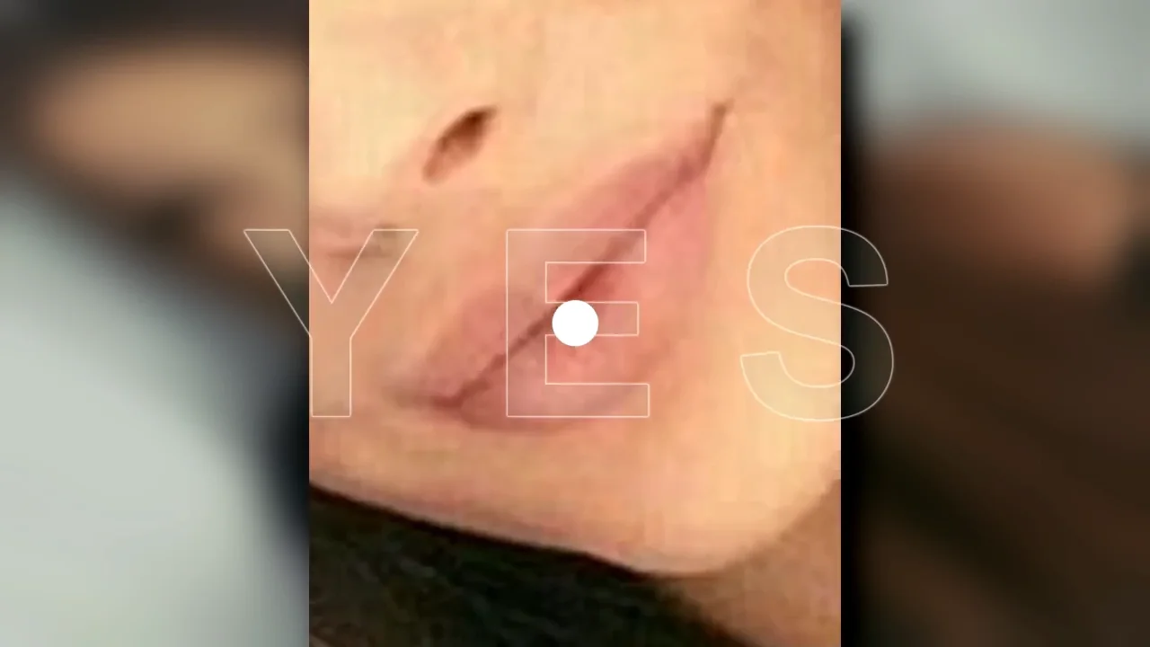 Thumbnail at 1:49