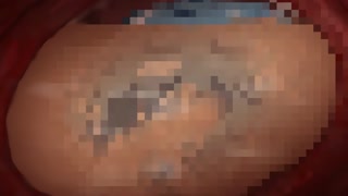 Thumbnail at 2:44