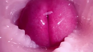 Thumbnail at 2:31