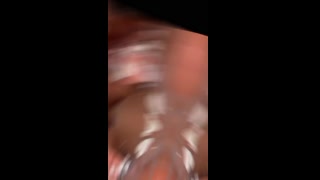 Thumbnail at 0:34
