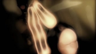 Thumbnail at 0:41