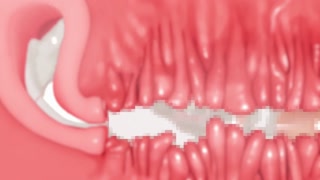 Thumbnail at 5:36