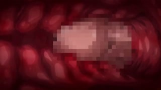 Thumbnail at 1:40