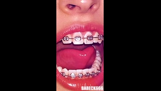 Thumbnail at 0:33
