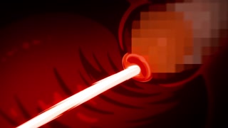 Thumbnail at 0:49